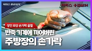 반죽 기계에 끼어버린 주방장의 손가락! 기계에 손이 끼었을 때 응급처치는? [닥터스 응급실24 응급의학과 의사 119 구급대원 의학 다큐 다시보기]