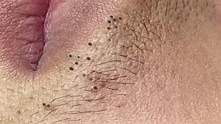 Satisfying Relaxation Skin Video With Dr. Thuy Quynh Giao Spa #03 31/05/2021