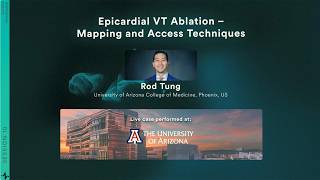 Live Case & Discussion: Epicardial VT Ablation – Mapping and Access Techniques | RIO 2025