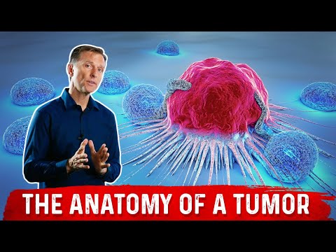 What Causes Tumors, Polyps, Moles & Pimples What Causes Tumors, Polyps, Moles & Pimples