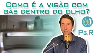 Visão embaçada após cirurgia de vitrectomia com gás?