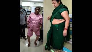 Total Knee Replacement Surgery Mulund Thane, Mumbai In Overweight People | Best Knee Surgeon Mumbai