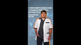 Новообразование альвеолярного отростка — Эмирбеков Э.А.