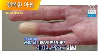 손발이 차갑고 저린다면? 끝이 파랗게 변한다면? 혈관 질환을 의심해라! | 행복한 아침 208회