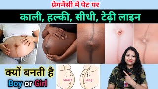 प्रेगनेंसी में नाभि पर सीधी या टेढ़ी रेखा क्यों बनती है। nabhi line during pregnancy।