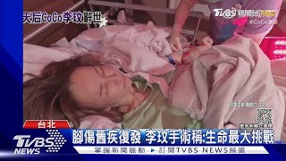 【星聞爆爆】李玟左腳天生缺陷 2歲手術失敗留陰影