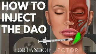 HOW TO INJECT THE DEPRESSOR ANGULI ORIS (DAO)