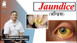 Jaundice  (जन्डिस)  Dr. Sudhamshu K.C (Sr. Consultant Liver Disease)  Bir Hospital