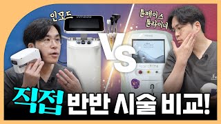 인모드vs튠페이스,튠라이너⚡ 반반 셀프 시술로 비교!!｜아파서 눈물 흘림...😥