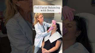 Full Facial Balancing with Botox #botox #beauty #filler