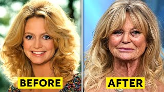 25 Celebrities Who Have Aged Badly