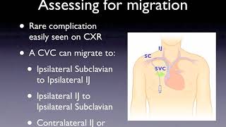 Sonographic Evaluation of Central Line Placement