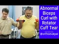 Abnormal biceps curl with rotator cuff tear