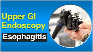 Esophagitis - Upper GI Endoscopy