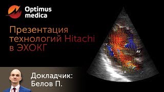 Новые технологии Hitachi для ЭХОКГ