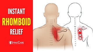 How to Fix Rhomboid Pain FOR GOOD