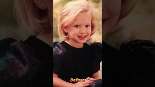 Hilary Duff Before After