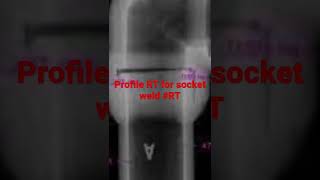 Profile RT for Socket weld #radiography testing