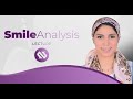 Smile Analysis Lecture by Dr Nermeen Nagy