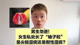 男生勿进！女性私处长小颗粒，到底是尖锐湿疣还是假性湿疣？