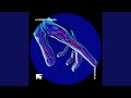 MIRACLE - HYPERTECHNO