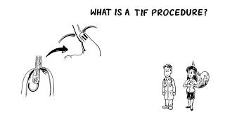 What Is TIF Procedure