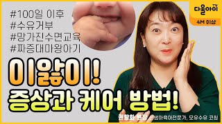 이앓이, 증상과 케어방법 #수유거부 #수면교육 #피부관리 #아기침