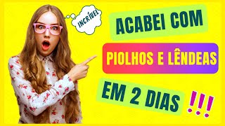 💥RECEITA DE PEDIATRA | COMO ACABAR com PIOLHOS e LÊNDEAS em 2 DIAS.