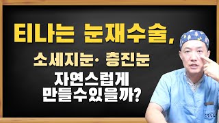 셀라성형외과★ 티나는 눈재수술, 소세지눈, 층진눈 자연스럽게 만들 수 있을까? 김융수원장의 티나는눈재수술 방법 대공개!!