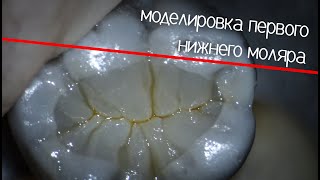 Моделировка Первый Нижний Моляр