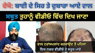 ਦੇਖੋ ਬਾਈ ਦੇ ਗੰਜੇ ਸਿਰ ਤੇ ਦੁਬਾਰਾ ਆਏ ਵਾਲ | Hair Growth without Transplant | @dstalanian