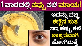 ಡಾರ್ಕ್ ಸರ್ಕಲ್ ಗೆ ಸಿಂಪಲ್ ಮನೆಮದ್ದು | How to Remove Dark Circles Naturally | effective remedies | ಕಲೆ