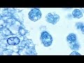CDC: Worker possibly exposed to Ebola