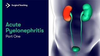 Acute Pyelonephritis | What is it and What Causes it?
