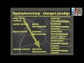 eans webinar hemispheric disconnection current state of the art