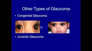 [UP Med Webinars] Glaucoma: Sneak Thief of Sight