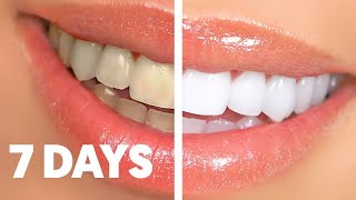 5 FAST Natural Teeth Whitening Methods!
