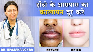 How to Remove Pigmentation Around the Mouth |Upasana Ki Duniya