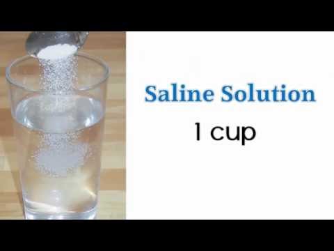 Yeast Infection Cure - The Best Way To Kill Vaginal Yeast Infection Naturally Yeast Infection Cure - The Best Way To Kill Vaginal Yeast Infection Naturally