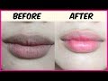 Apply This Mixture Before Going To Bed & Get Glossy Pink Lips Naturally Apply This Mixture Before Going To Bed & Get Glossy Pink Lips Naturally