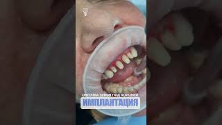 От клиновидных дефектов до временных коронок. From wedge-shaped defects to temporary crowns.