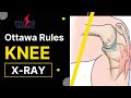 Knee X-ray, Ottawa Rules of Investigation |Physiotrendz |Knee Pain |X-ray