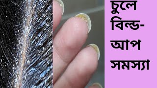 চুলের এই ময়লার কারনে আপনার মাথার চুল পড়ে যাচ্ছে কি। চুলের বিল্ডআপ  সমস্যা। Remove Hair Buildup