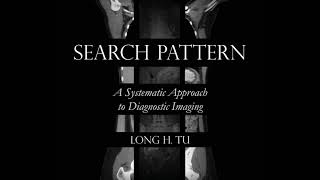 Introduction to the "Search Pattern" Video Series