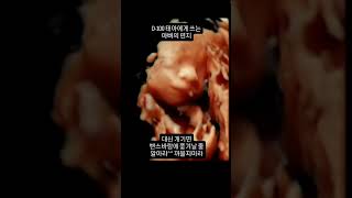 입체초음파로 본 아기에게 아빠가 쓰는 편지 #부부 #신혼부부 #임신 #출산 #육아