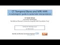 Otology |  A guide to CT Temporal Bone and MRI IAM | Dr Paddy Wilson