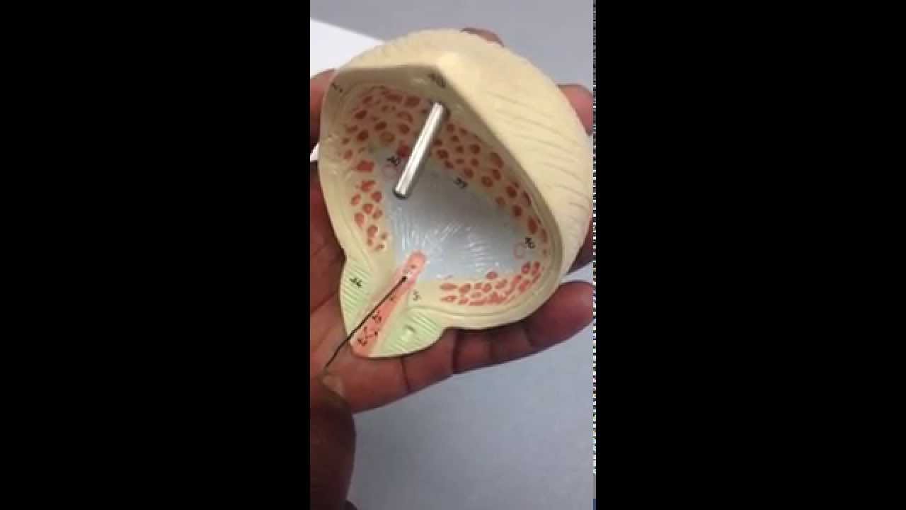 Urinary Bladder Model Walkthrough - YouTube