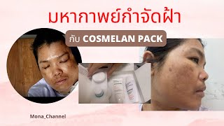 มหากาพย์กำจัดฝ้ากับ Cosmelan new pack จะปังหรือจะพัง /Part 2 รีวิวหลังใช้ 30วัน