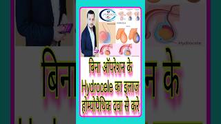 बिना ऑपरेशन के Hydrocele का इलाज होम्योपैथिक दवा से करे#hydrocele #shorts #youtubeshorts #homeopathy