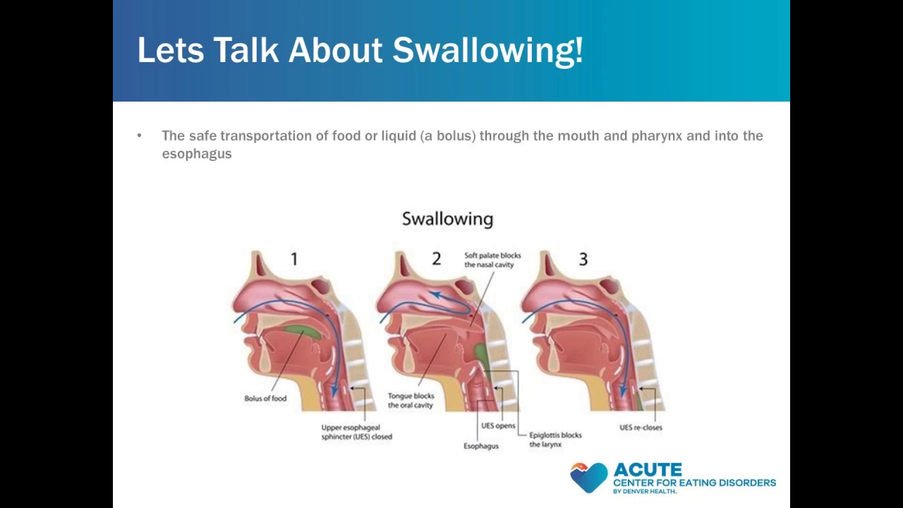 Dysphagia: Difficulty Swallowing And Eating Disorders - YouTube